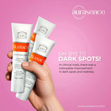 TRANACIX Skin Tone Imperfections Care Cream with 3% Tranexamic acid | Reduces Melasma | Fades dark spots – 30g