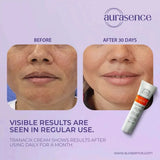 TRANACIX Skin Tone Imperfections Care Cream with 3% Tranexamic acid | Reduces Melasma | Fades dark spots – 30g