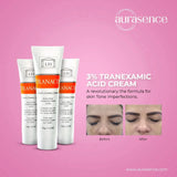 TRANACIX Skin Tone Imperfections Care Cream with 3% Tranexamic acid | Reduces Melasma | Fades dark spots – 30g