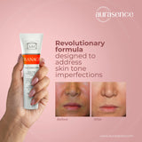 TRANACIX Skin Tone Imperfections Care Cream with 3% Tranexamic acid | Reduces Melasma | Fades dark spots – 30g