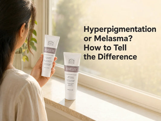 Hyperpigmentation or Melasma? How to Tell the Difference