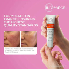 TRANACIX  Skin Tone Imperfections Care Cream with 3% Tranexamic acid | Reduces Melasma | Fades dark spots  – 30g