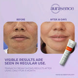 TRANACIX  Skin Tone Imperfections Care Cream with 3% Tranexamic acid | Reduces Melasma | Fades dark spots  – 30g