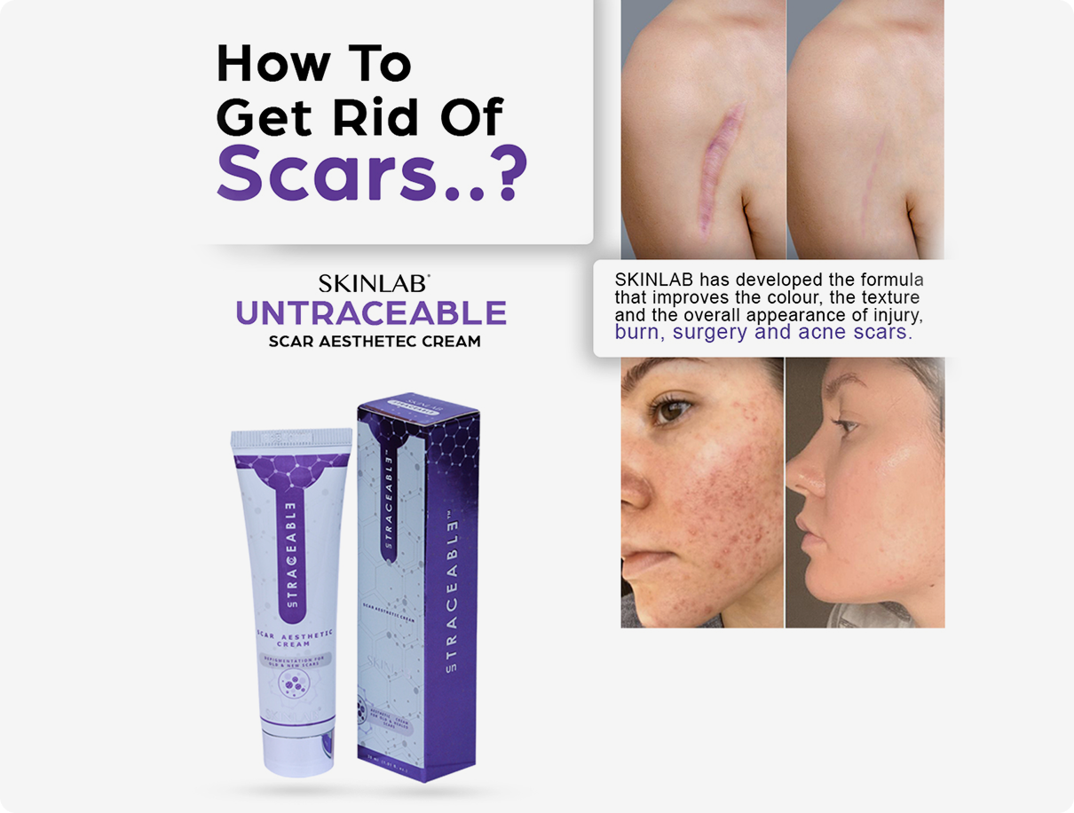 SKINLAB Untraceable scar cream advertisement with before and after images of scars.