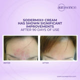 SODERMIX Soothing Repairing Cream | steroid-free solution for hypertrophic and keloid scars- 30ml