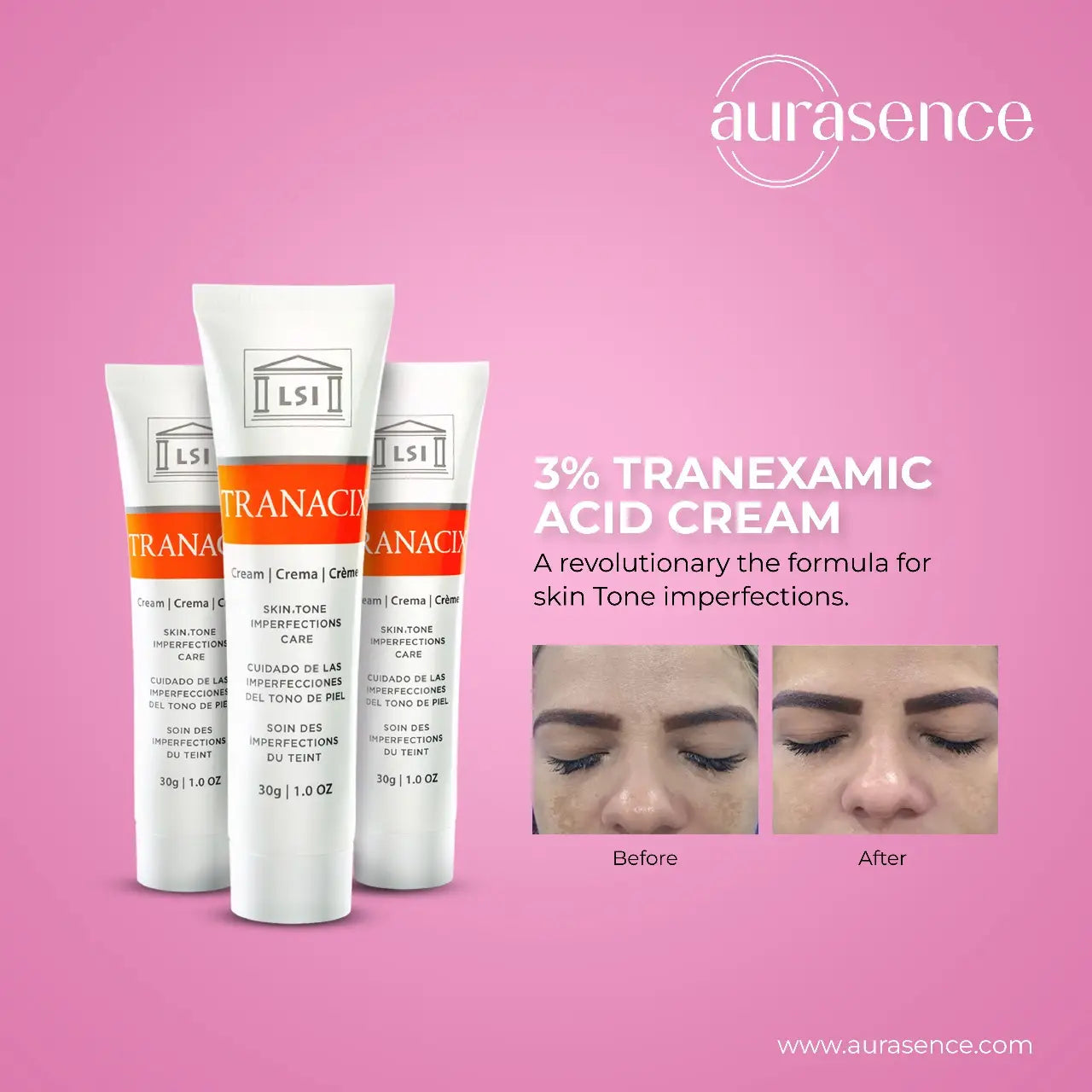 TRANACIX  Skin Tone Imperfections Care Cream with 3% Tranexamic acid | Reduces Melasma | Fades dark spots  – 30g