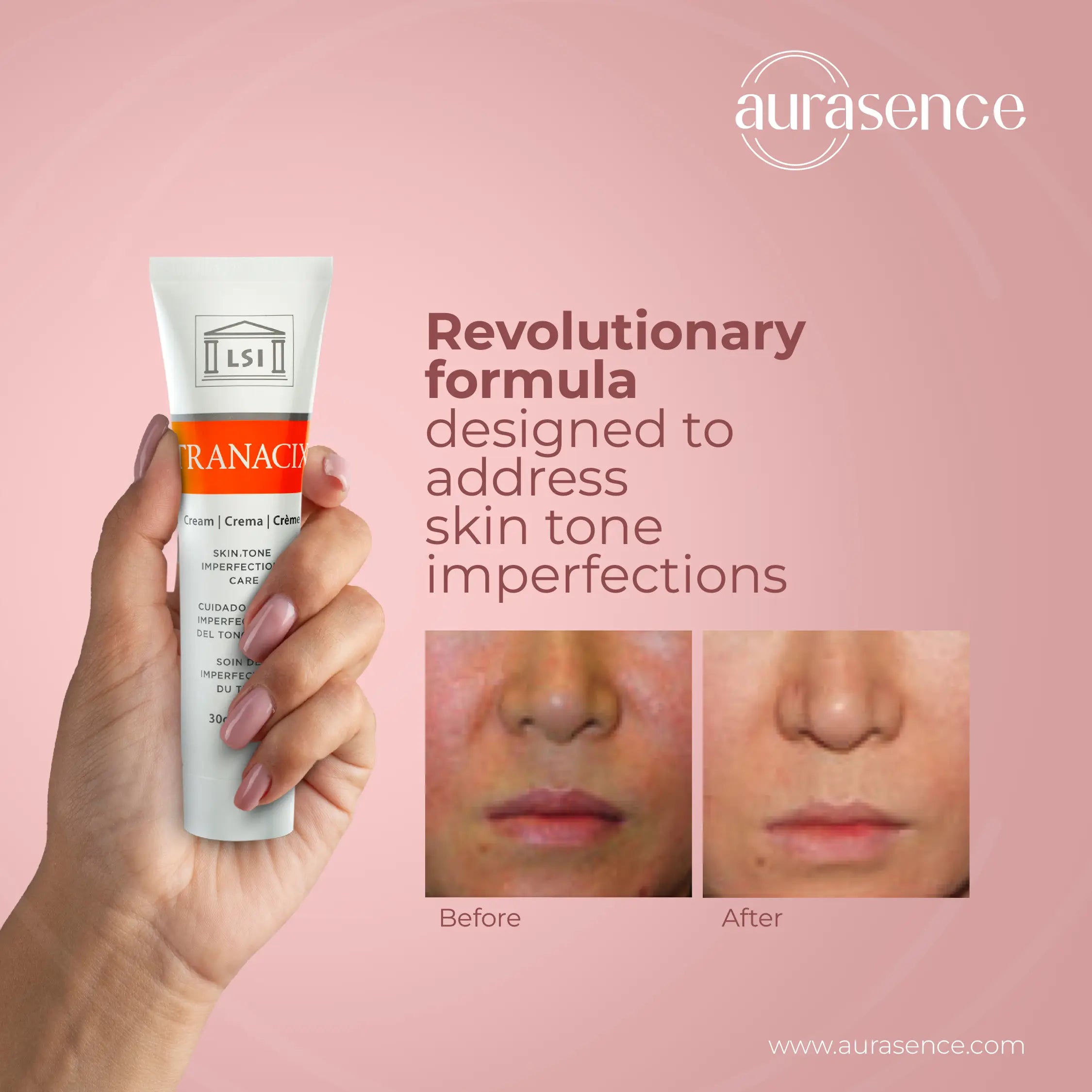TRANACIX  Skin Tone Imperfections Care Cream with 3% Tranexamic acid | Reduces Melasma | Fades dark spots  – 30g