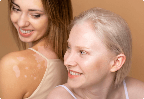 Two women with visible skin conditions
