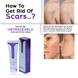 SKINLAB Untraceable Dark Spot & Scar Remover Cream | With Niacinamide, Vitamin B5 & Antioxidants | 30ml